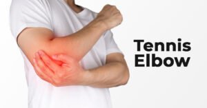 Tennis Elbow Causes, Symptoms, and Treatments