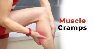 Muscle Cramps: Causes, Diagnosis, Treatments, and Prevention