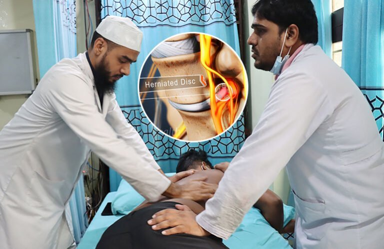Can Physiotherapy Help Patients with Herniated Discs/PLID in the Lower ...