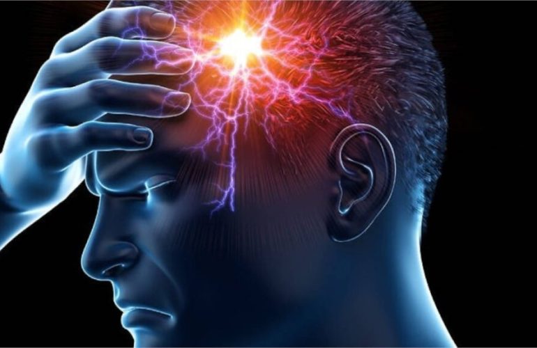 Pain in the scalp ()